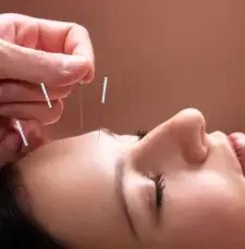 Naturopathe en Médecine Traditionnelle Chinoise