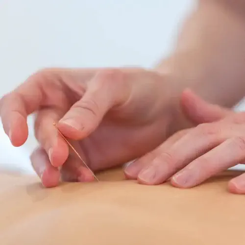 La formation de médecine traditionnelle chinoise​