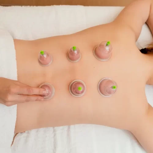 Acupuncteur Yens | Aline Max Acupuncture | MTC